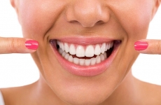 dinți, implant dentar
