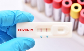 test COVID-19
