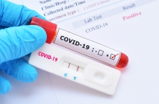 COVID-19 test pozitiv