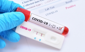 COVID-19 test pozitiv