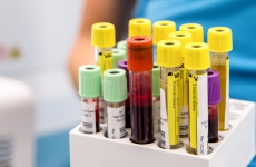 sange analize sanguin