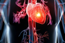 inima miocardita