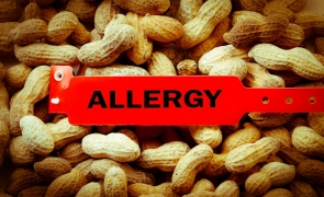 alergie arahide alune