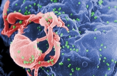 HIV virus