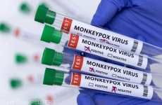 variola maimutei monkeypox virus