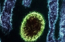 henipavirus