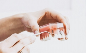 implant dentar dentist