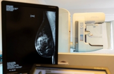 mamografie 