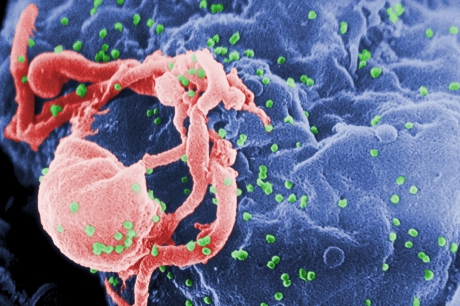 FDA aprobă în SUA un tratament promiţător împotriva HIV, Yeztugo, produs de Gilead